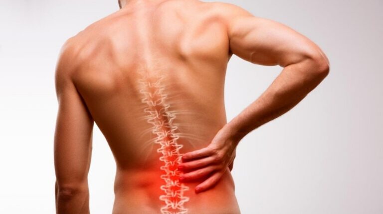 Persona con dolor lumbar, una dolencia que puede dar lugar a una incapacidad permanente por lumbalgia.